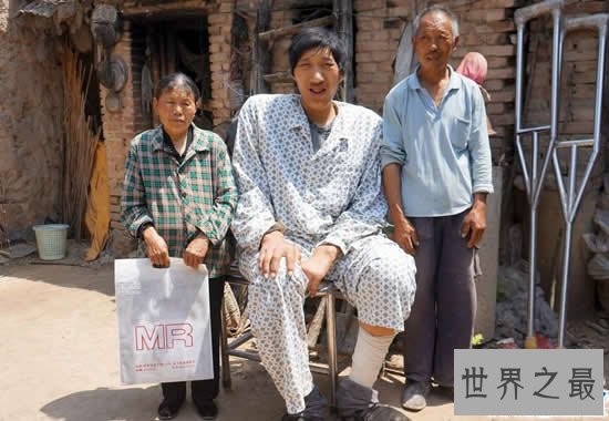 中国最高的人徐福海,26岁身高达2.43米(还在长)