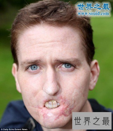 世界上最恶心的人,又丑又恶心的男人女人(慎入)