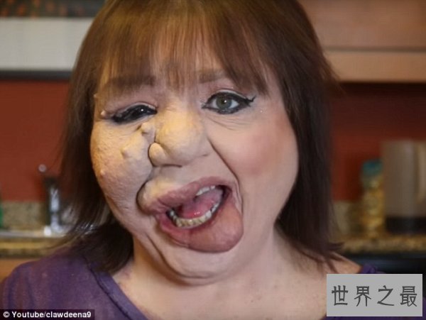 世界上最恶心的人,又丑又恶心的男人女人(慎入)