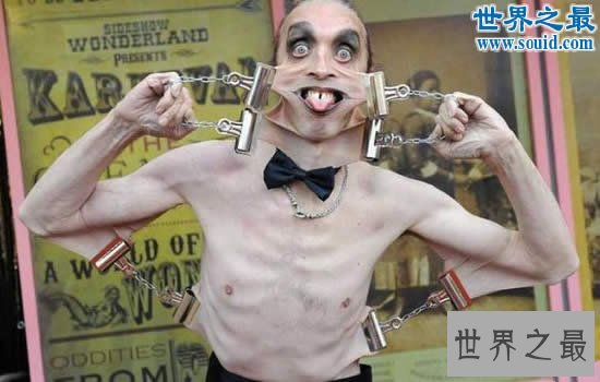 世界上皮肤最有弹性的人,下巴皮肤盖住嘴巴(图)