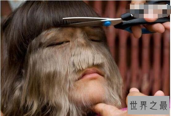世界上体毛最长的人艾米丽·苏珊,剪了之后是个美女