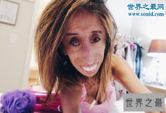 世界上最丑的女人,被恶毒诅咒快去死(励志逆袭)