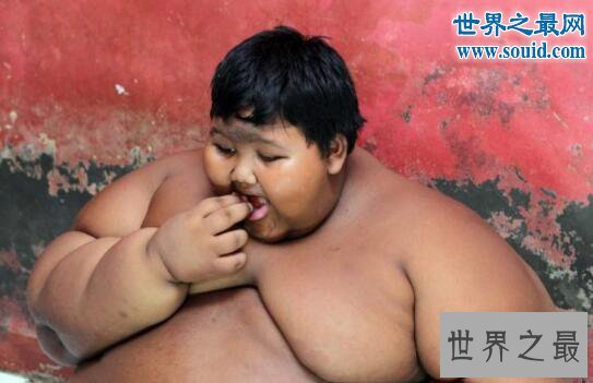 世界上最胖的男孩,印尼男孩年仅10岁重达384斤
