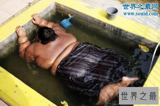 世界上最胖的男孩,印尼男孩年仅10岁重达384斤