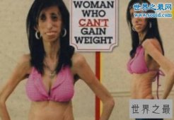 世界上最瘦零脂肪女孩，丽兹·维拉斯奎兹(仅重54斤)