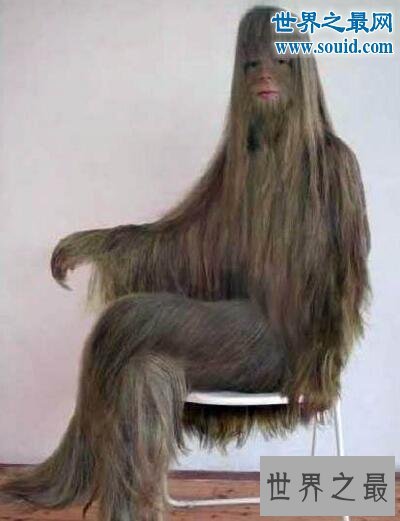 世界上体毛最长的人，艾米丽.苏珊(人类返祖现象)