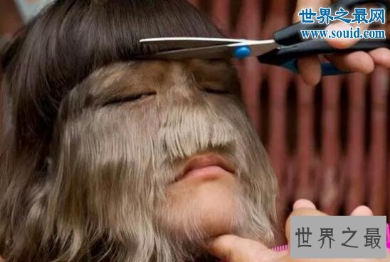 世界上体毛最长的人，艾米丽.苏珊(人类返祖现象)