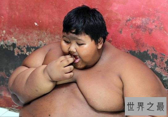 世界上最胖的孩子，10岁体重既达到384斤