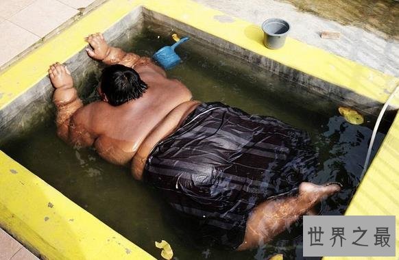 世界上最胖的孩子，10岁体重既达到384斤