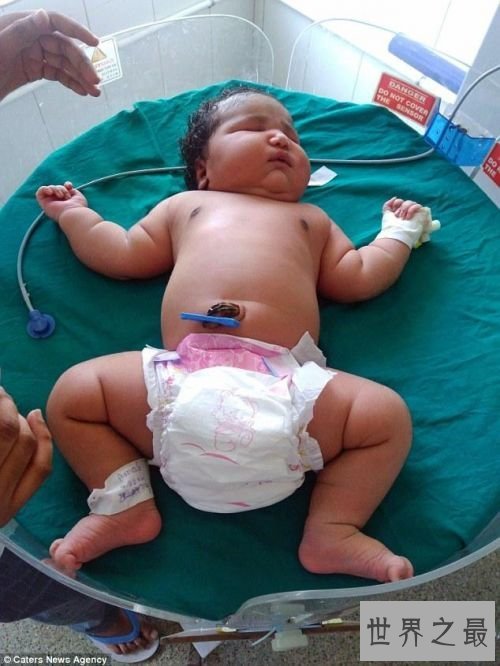 世界上最重的女婴，印度19岁女孩生13.6斤重巨婴