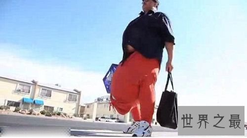 世界上最大的睾丸,重达120斤(太大影响正常生活)