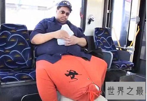 世界上最大的睾丸,重达120斤(太大影响正常生活)