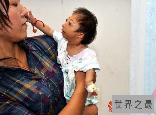 中国女童身高只有54厘米,可能是世界上最矮的人