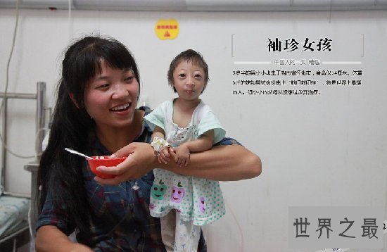 中国女童身高只有54厘米,可能是世界上最矮的人