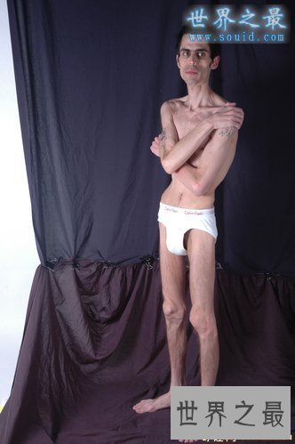 世界最瘦的男人，体重只有82斤(皮包骨头)