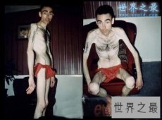 世界最瘦的男人，体重只有82斤(皮包骨头)