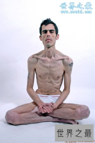 世界最瘦的男人，体重只有82斤(皮包骨头)