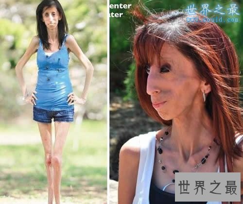 世界上最瘦的女人，像纸人一样(25公斤)