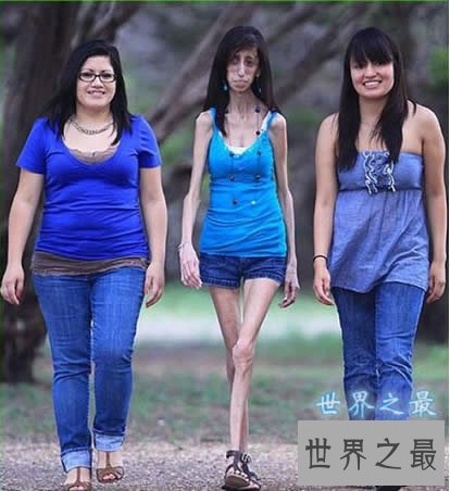 世界上最瘦的女人，像纸人一样(25公斤)