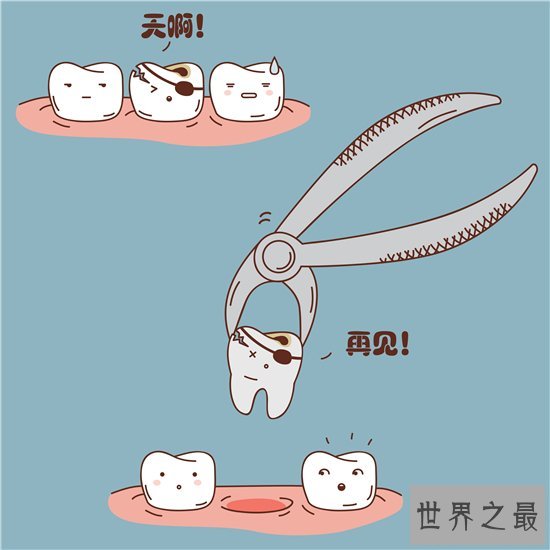 虫牙怎么办?长期清洁不当则会造成牙齿损坏