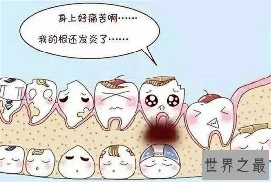 虫牙怎么办?长期清洁不当则会造成牙齿损坏