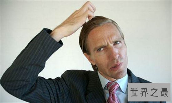 头皮痒怎么办？多种原因让你改善头皮问题