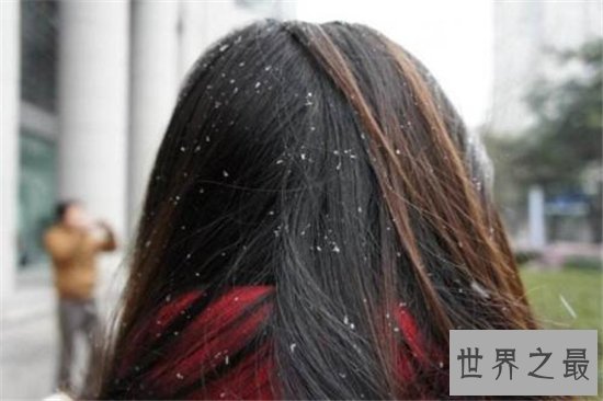 头皮痒怎么办？多种原因让你改善头皮问题