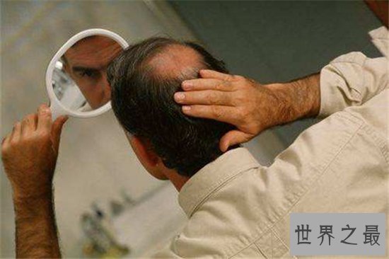 头皮痒怎么办？多种原因让你改善头皮问题