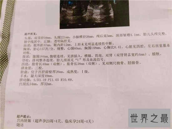 清宫表怎么看？生男生女具有科学依据与基因有关