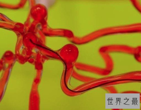 世界第一款磁控线性机器人,在脑血管中自由穿梭