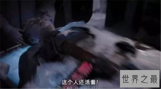 世界首例冷冻人,2017年詹姆斯·贝德福复活(图片)