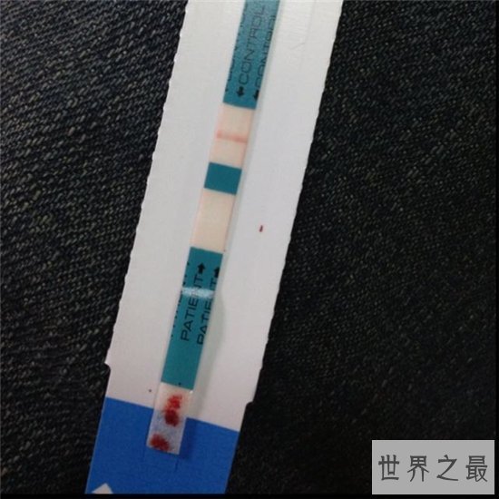 测癌试纸用来检测胰腺癌,价格低廉有效度惊人