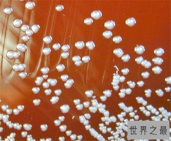 10个关于细菌的奇怪发现,有的细菌竟然可以生产纯金!