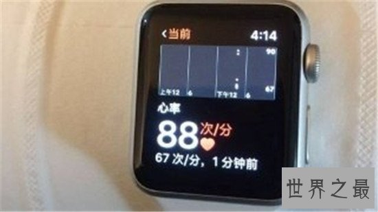 未来十大概念手机,手腕上的手机真的会出现吗