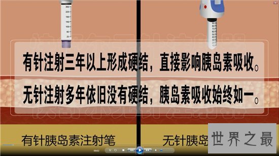 无针注射器用于糖尿病患者,随时都可以注射胰岛素