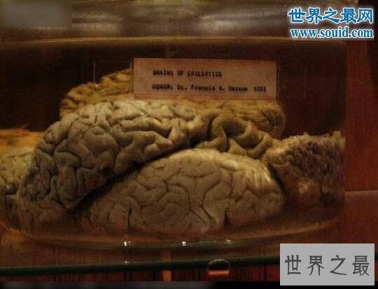 世界上最恐怖博物馆,美国费城马特博物馆(全是器官)