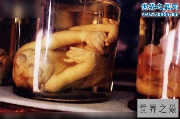世界上最恐怖博物馆,美国费城马特博物馆(全是器官)
