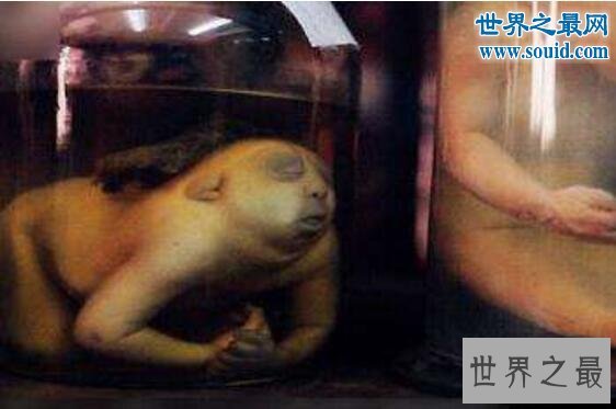 世界上最恐怖博物馆,美国费城马特博物馆(全是器官)