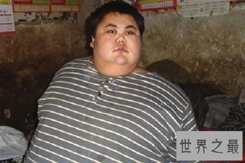 中国第一胖孙亮，体重高达600相当于4个成年人