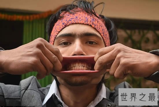 最新世界第一大嘴,尼泊尔男子嘴巴插进138支铅笔