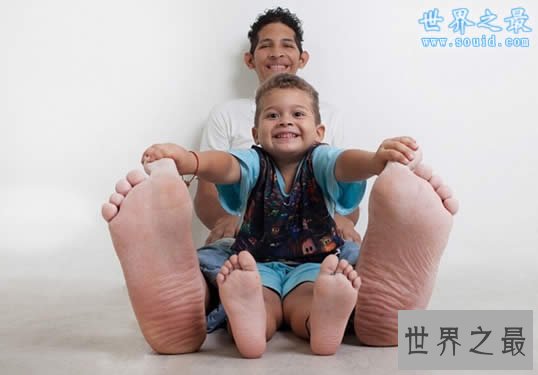 世界上脚最长最大的人,脚长达0.4米(图)