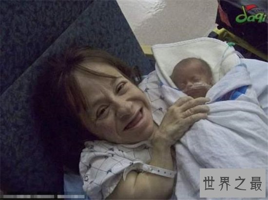 世界最小母亲斯泰西.赫拉尔德,天生患有脆骨病