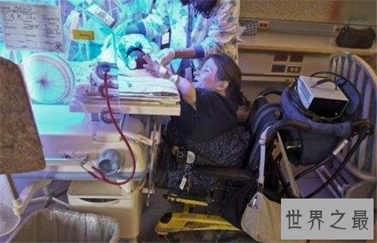 世界最小母亲斯泰西.赫拉尔德,天生患有脆骨病