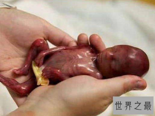 世界上最小的婴儿,还没有一支笔大