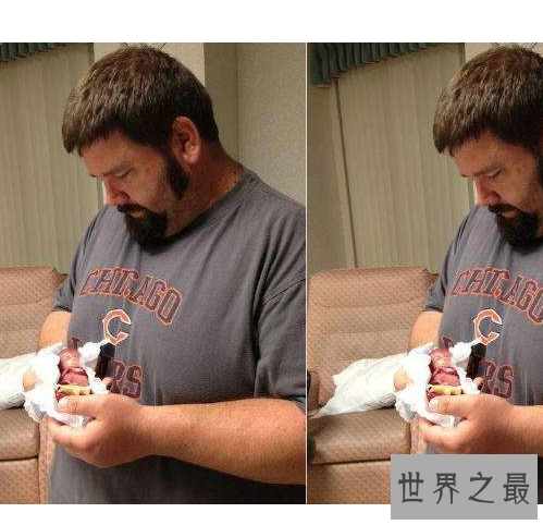 世界上最小的婴儿,体重只有250克和一个鸡蛋一样重。