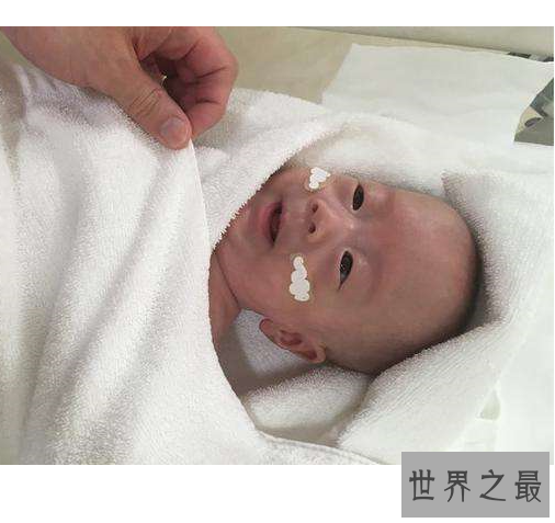 世界上最小的婴儿,体重只有250克和一个鸡蛋一样重。