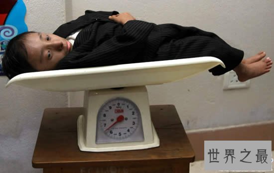世界上体重最轻的人,18岁少年体重仅11斤(图)