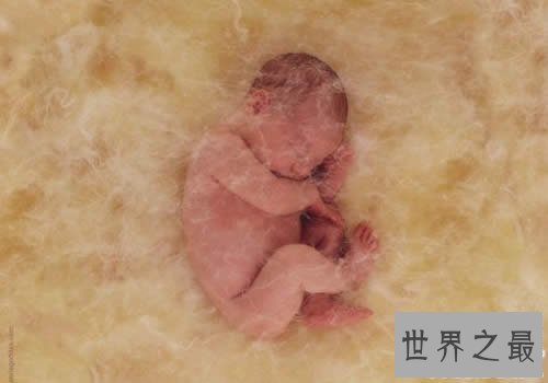 世界上阴茎最短小的男人,一生都只有2.5厘米