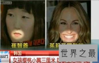 世界上嘴巴最小的人，樱桃小嘴只有3厘米