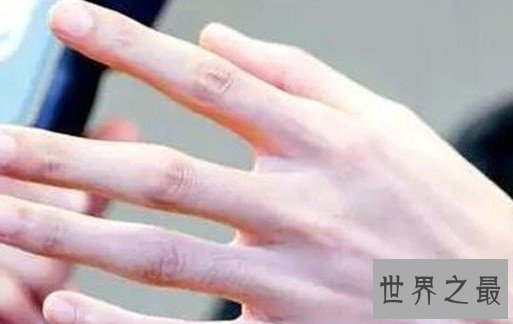 世界上最快的手指,一秒钟敲击琴键13次